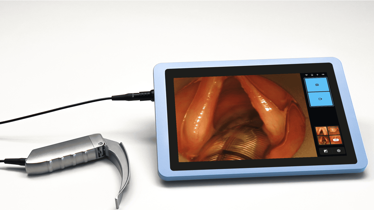 Laryngoscope with display device