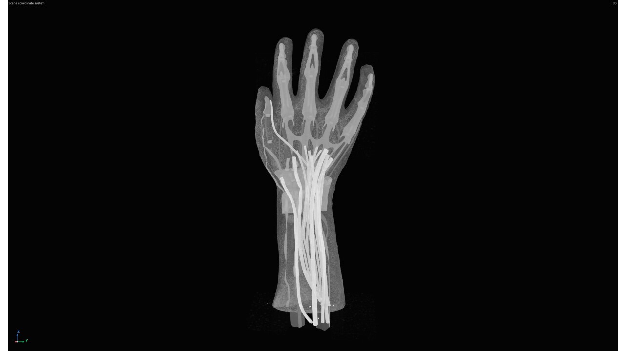 CT Bildgebung der Hand