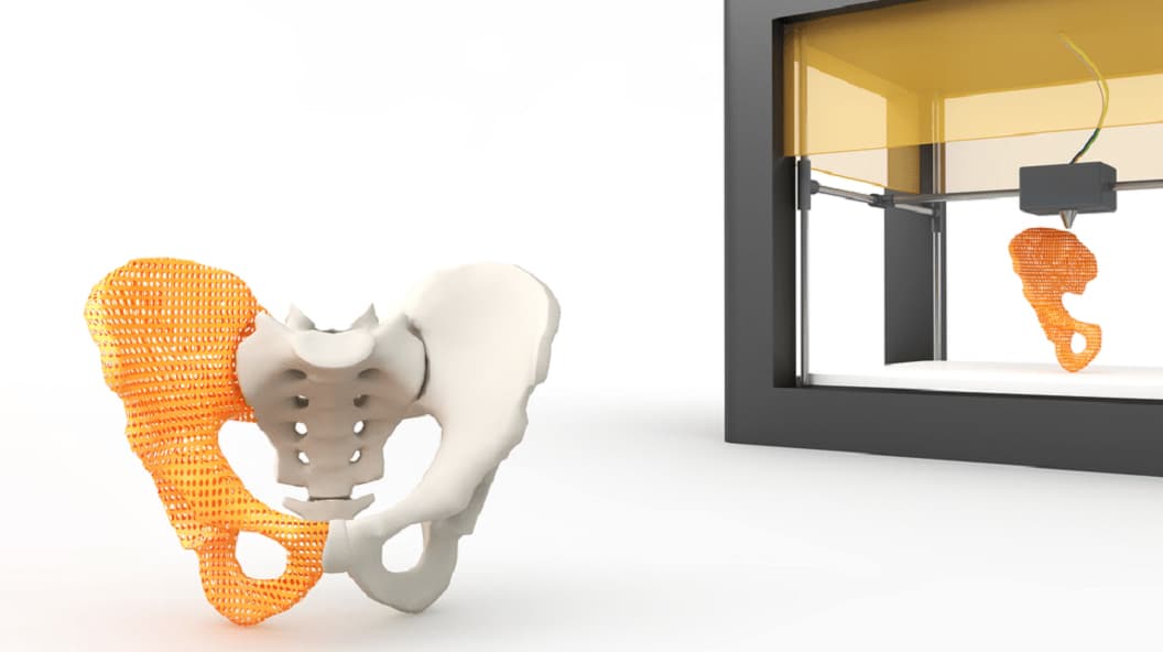 Patient-specific, additive manufactured products at Innovation Symposium of Swiss Medtech Expo
